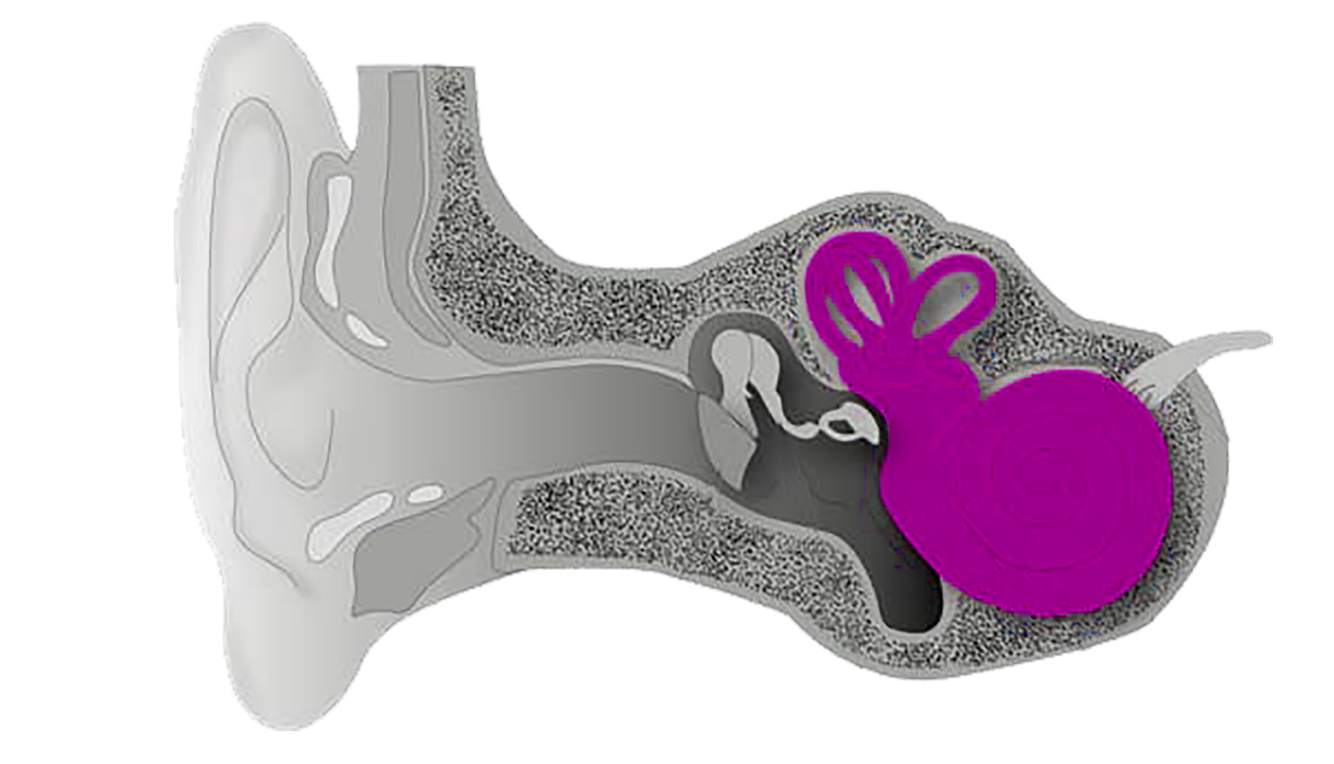 Sensorineural 1